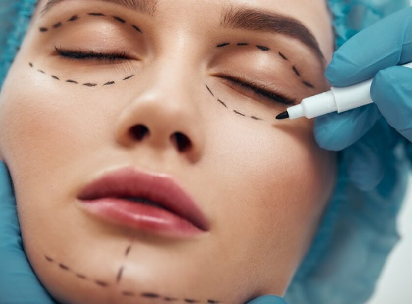 Becoming perfect. Close up photo of young woman with glowing skin in blue medical hat waiting for facial surgery while plastic surgeon in blue gloves drawing dashed line under eyes